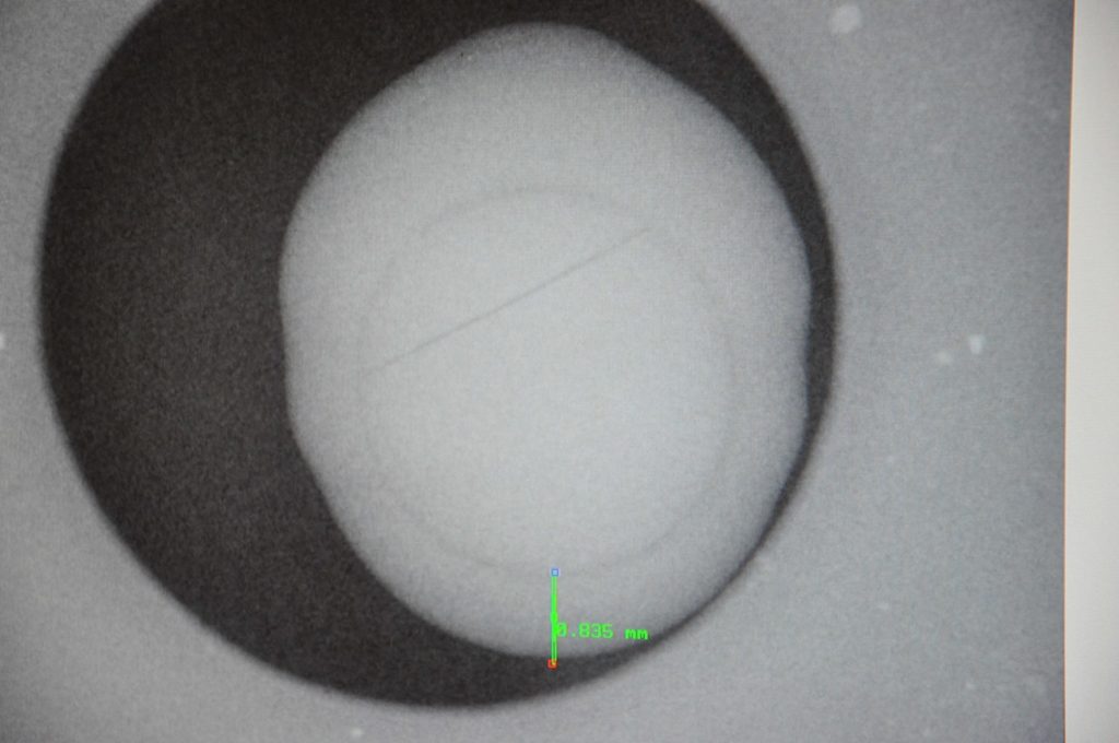 Radiographie d'une perle de culture montrant le noyau et la nacre